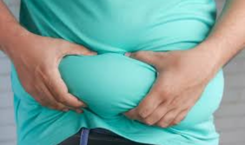 paying for weight loss surgery